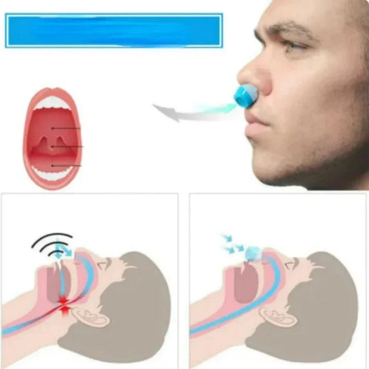 2-in-1 Anti Snore Device and Air Purifier Nose Clip