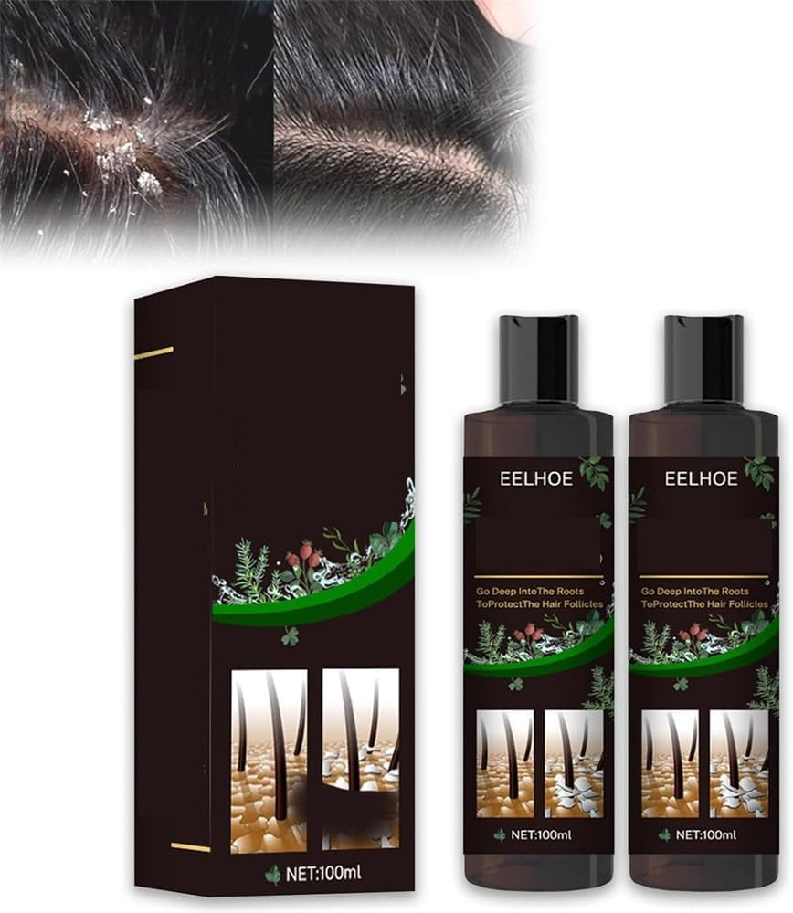 Anti-Itch Hair Growth Shampoo – Moisturizing Scalp Treatment for Dry Frizzy Hair Repair and Root Strengthening