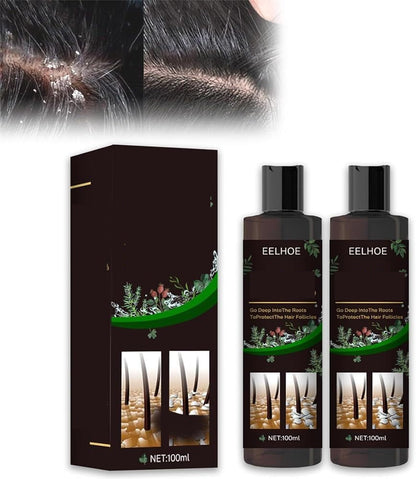 Anti-Itch Hair Growth Shampoo – Moisturizing Scalp Treatment for Dry Frizzy Hair Repair and Root Strengthening