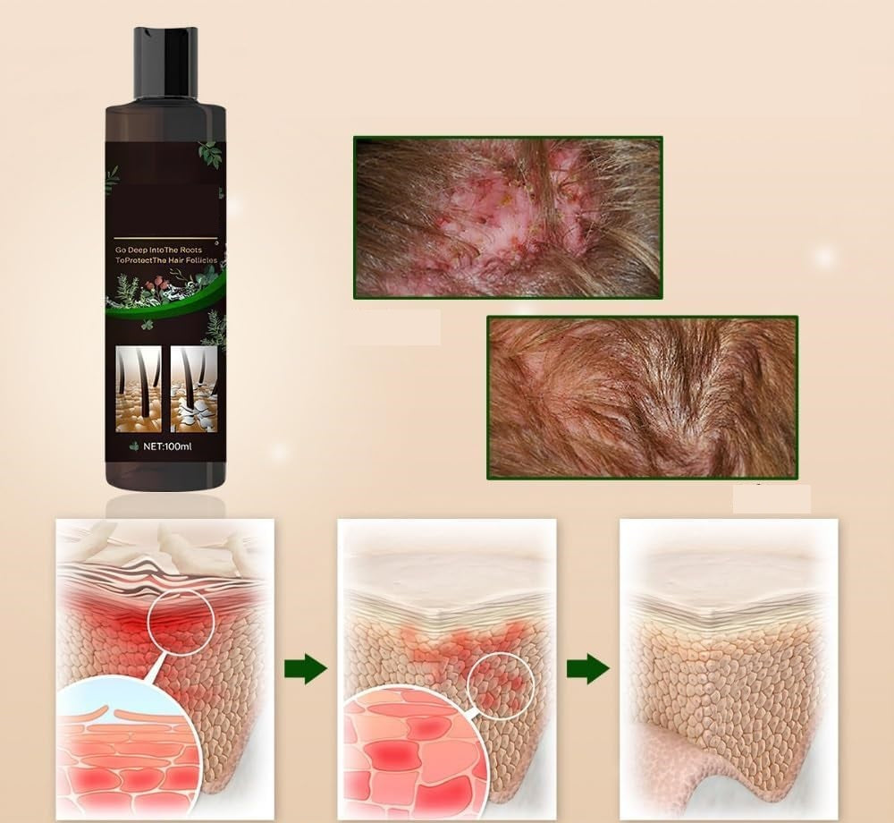 Anti-Itch Hair Growth Shampoo – Moisturizing Scalp Treatment for Dry Frizzy Hair Repair and Root Strengthening