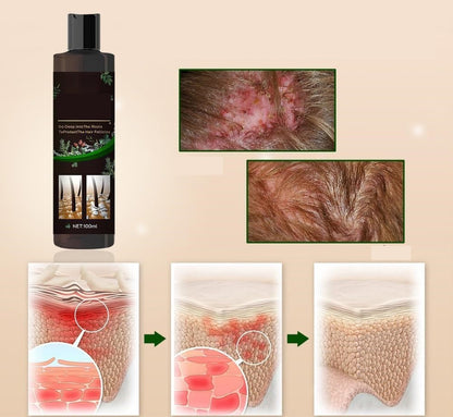Anti-Itch Hair Growth Shampoo – Moisturizing Scalp Treatment for Dry Frizzy Hair Repair and Root Strengthening