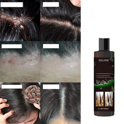 Anti-Itch Hair Growth Shampoo – Moisturizing Scalp Treatment for Dry Frizzy Hair Repair and Root Strengthening