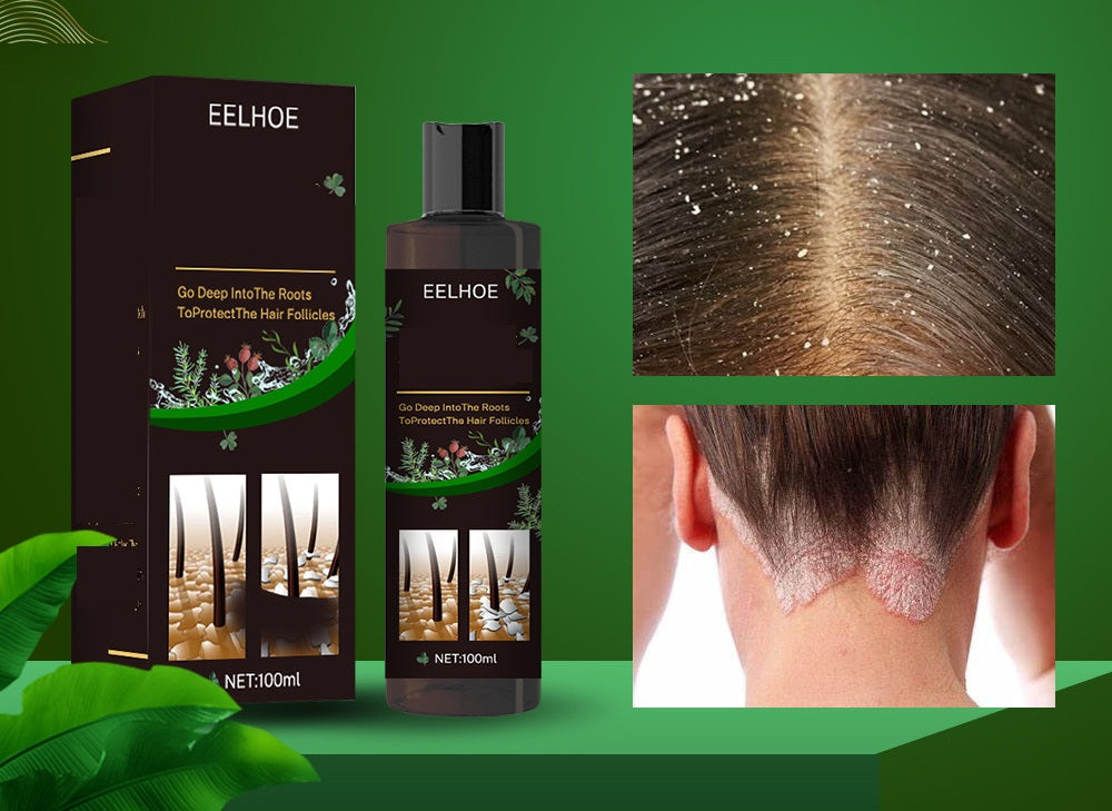 Anti-Itch Hair Growth Shampoo – Moisturizing Scalp Treatment for Dry Frizzy Hair Repair and Root Strengthening