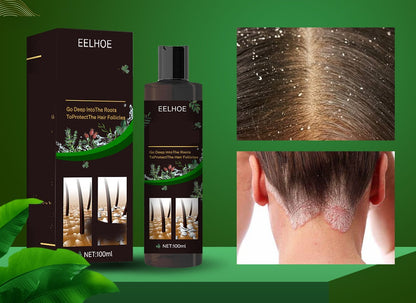 Anti-Itch Hair Growth Shampoo – Moisturizing Scalp Treatment for Dry Frizzy Hair Repair and Root Strengthening